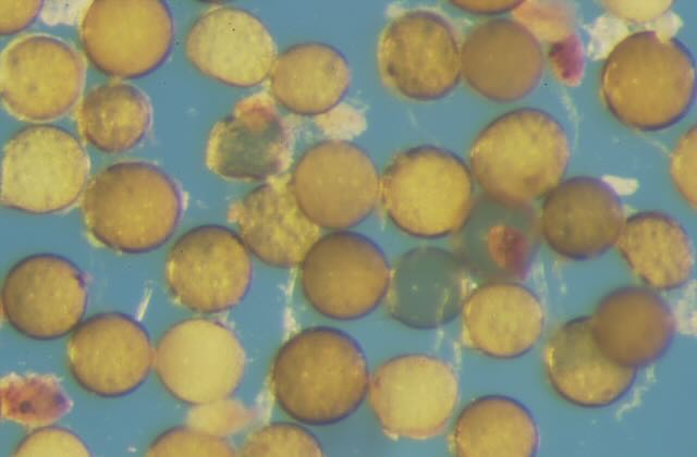 Glomus etunicatum mycorrhizal spore